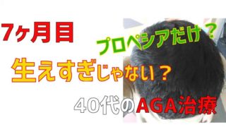 ハゲの克服はプロペシアだけでも髪が増えすぎた【薄毛治療6ヶ月経過】