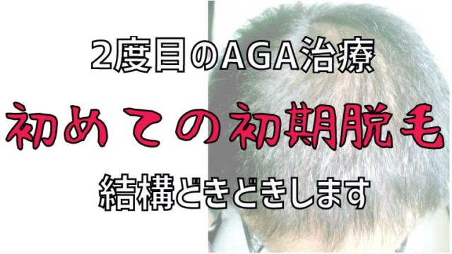 AGA治療は何度でも薄毛が治るのか検証【2ヶ月目】