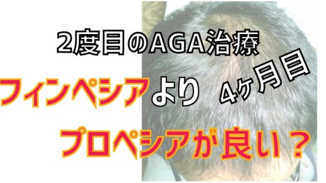 AGAはフィンペシアよりプロペシアの方が効果あるかも【4ヶ月目】