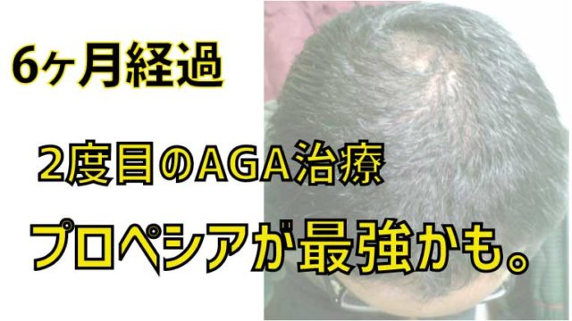 プロペシアがハゲに一番効果あると思う【2回目のAGA治療6ヶ月】