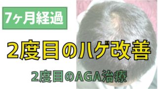 40代だからはげてもいいとは思えない・2回目のAGA治療7ヶ月目